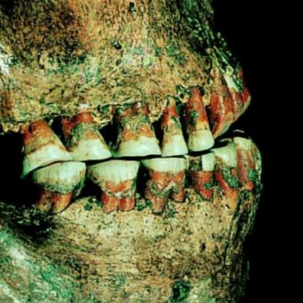 Zęby człowieka epoki kamienia.