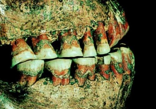 Zęby człowieka epoki kamienia.
