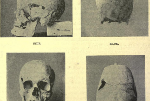 Prawdopodobnie czaszka egipskiego faraona Sanakhty. Nowe badania wskazują na władcę jako na najstarszego znanego w historii olbrzyma.