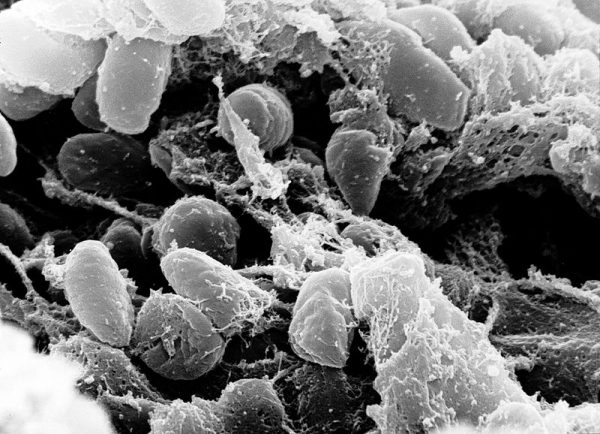 Znalezione w Szwecji DNA pałeczek dżumy (na zdj. wywołująca chorobę Yersinia pestis) prawdopodobnie stanowi genetyczne źródło plag nawiedzających Europę w średniowieczu.