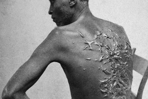 Katowani za życia niewolnicy (na zdj. czarnoskóry mężczyzna z bliznami po batach, fotografia wykonana w Luizjanie w 1863 roku) nawet po śmierci nie zaznali spokoju. Profesorowie Penn wykorzystywali ich ciała jako "pomoce dydaktyczne".